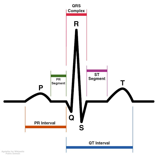 EMS Cardiology – EKG Rhythms
