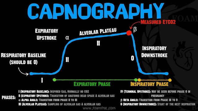 EMS Patient Monitoring – Capnography 3