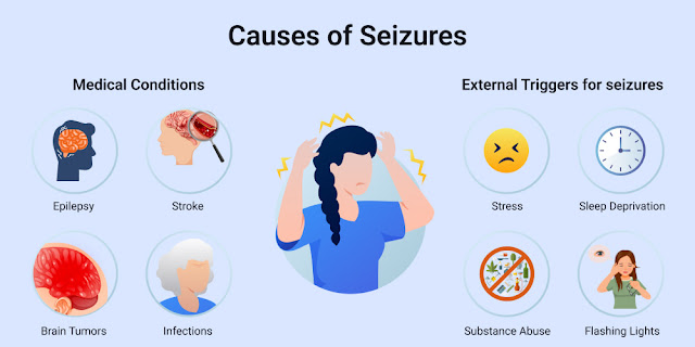 EMS Neurological Emergencies – Seizure Disorder Causes