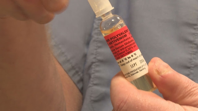 EMS Discussion – When Scope Meets Survival