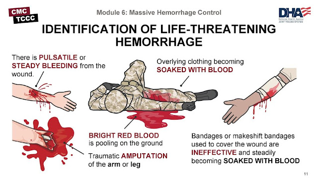 Understanding MARCH – A Tactical Approach to Massive Hemorrhage